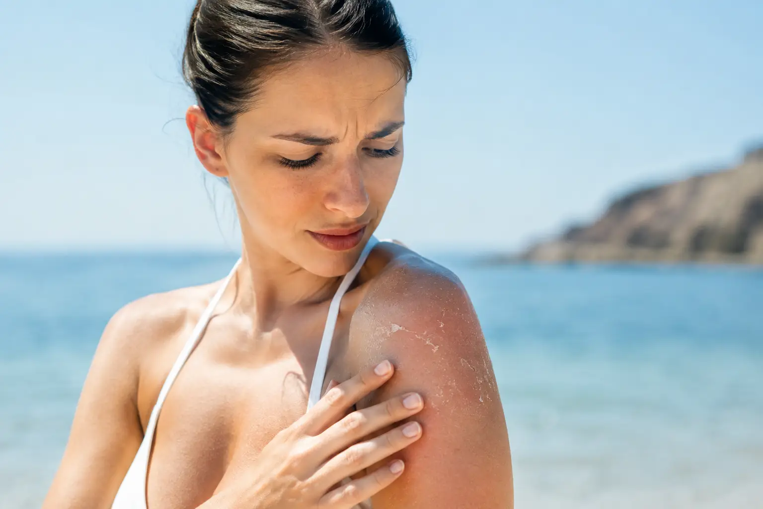 Peeling en été : quels risques pour la peau ?